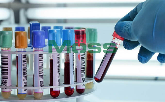 Phát hiện mới trong xét nghiệm máu có ý nghĩa to lớn